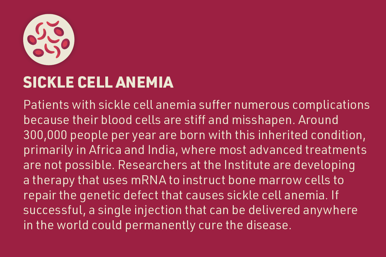 An educational graphic about the use of mRNA technology in treating Sickle Cell Anemia. The background is deep maroon with a white circle containing a stylized icon of a red sickle cell. The text explains the complications faced by patients with sickle cell anemia due to the stiffness and misshapen nature of their blood cells. It highlights that approximately 300,000 people are born with this inherited condition annually, mainly in Africa and India. The text describes ongoing research efforts to develop a therapy using mRNA to instruct bone marrow cells to repair the genetic defect responsible for sickle cell anemia, potentially leading to a permanent cure with a single injection.